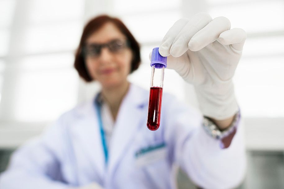 Tudo o que você precisa saber sobre Hemofilia: Uma Visão Cardiológica